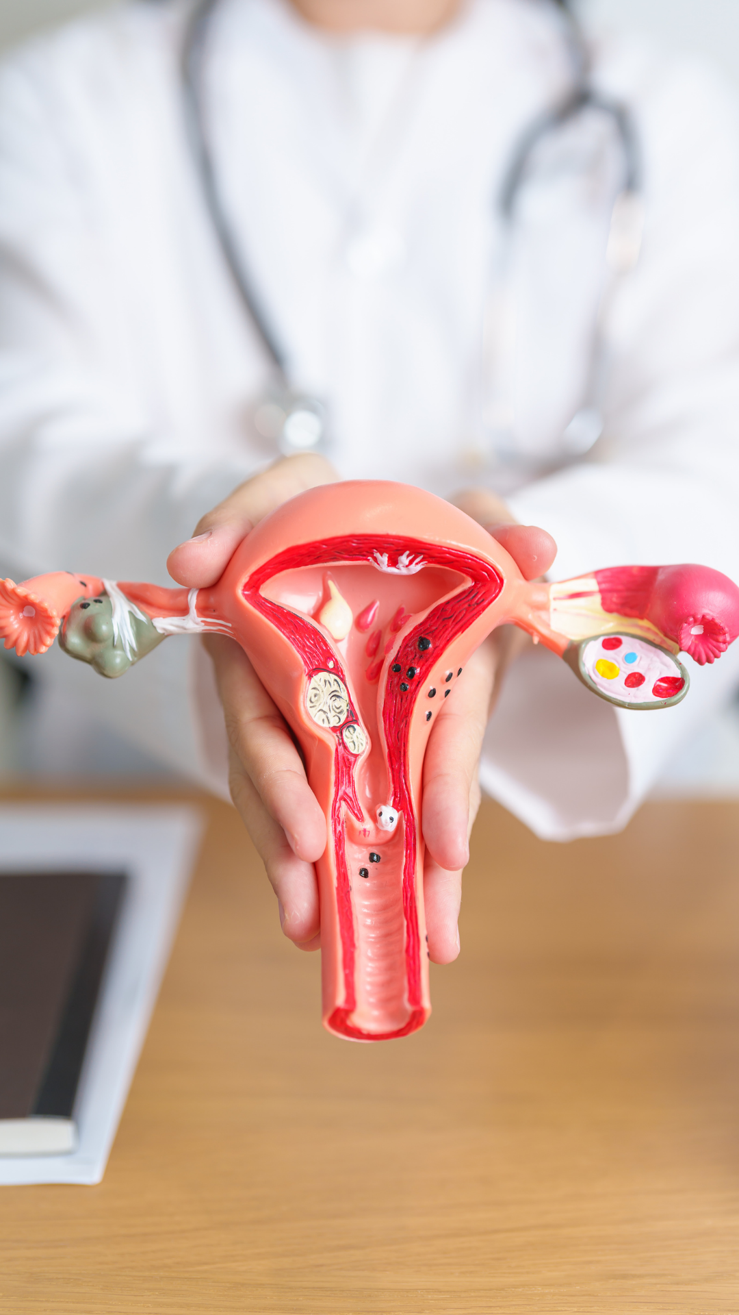 Rahim Ağzı (Serviks) Kanseri